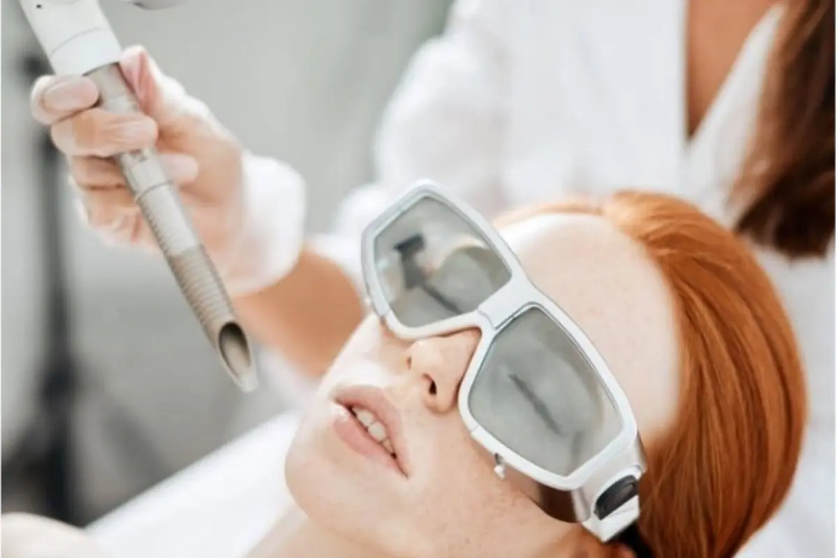 Fotona 4D™ Laser Facelift