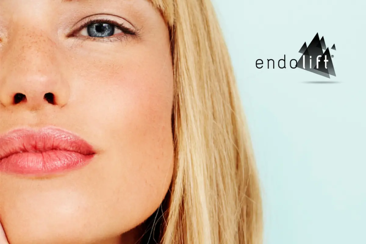 Endolift®